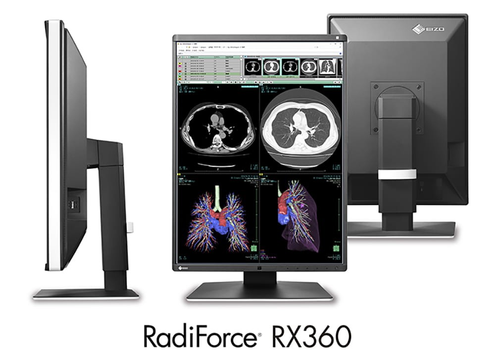 EIZO RadiForce RX360