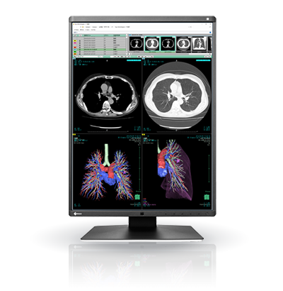 EIZO RadiForce RX360
