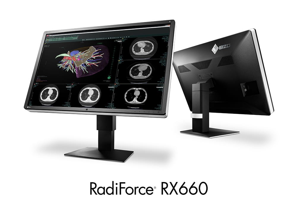 EIZO RadiForce RX660