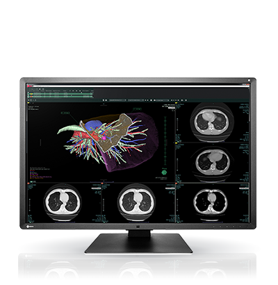 EIZO RadiForce RX660