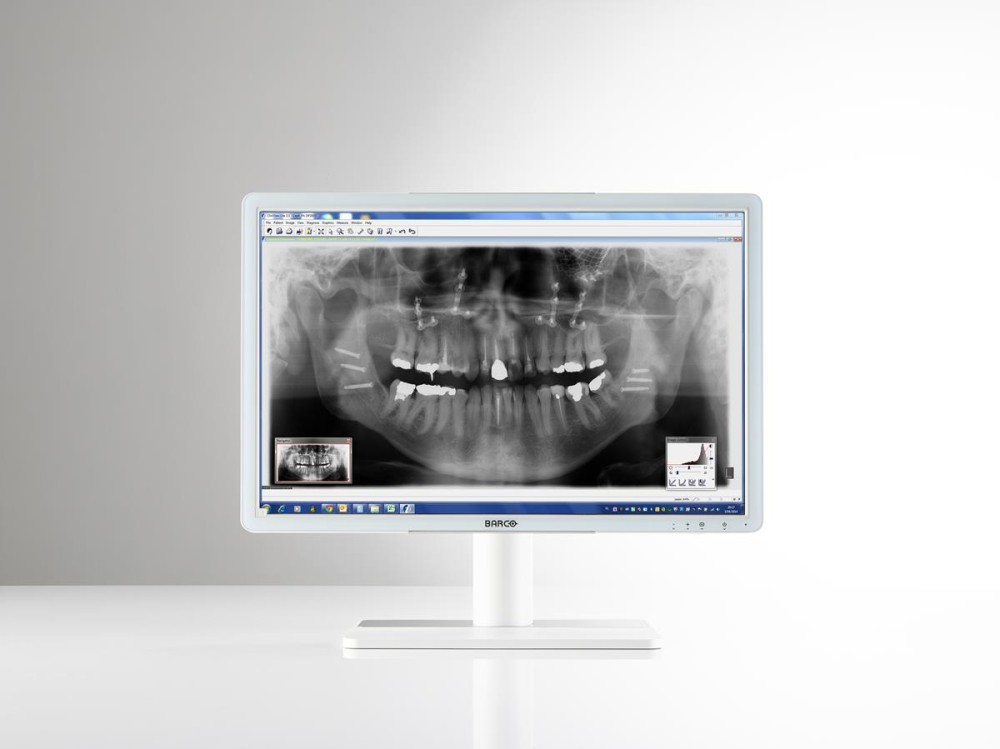 Barco Eonis 24" (MDRC-2224 WP) Dental