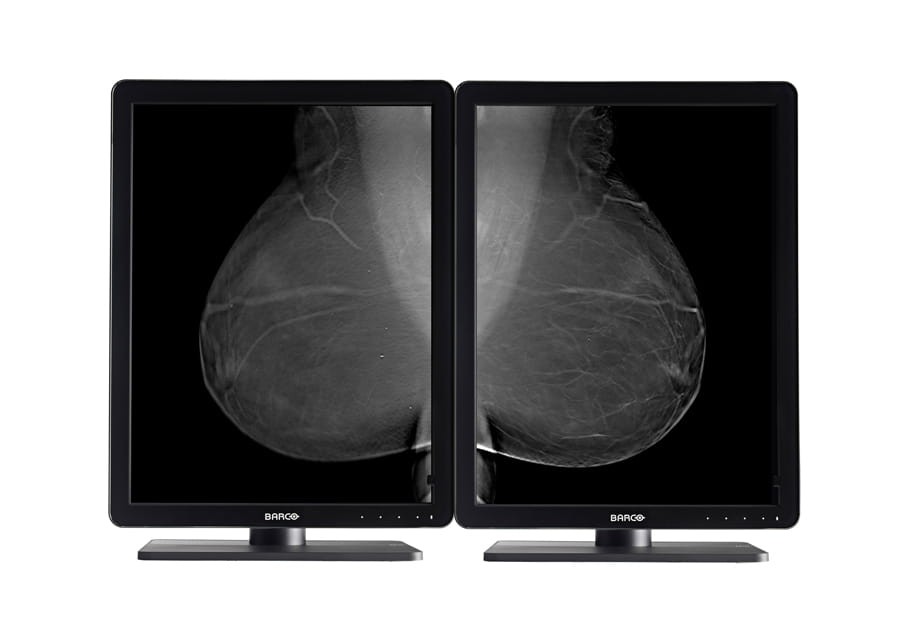 Barco Nio 5MP LED (MDNG-5221)