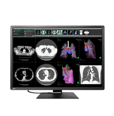 EIZO RadiForce RX1270