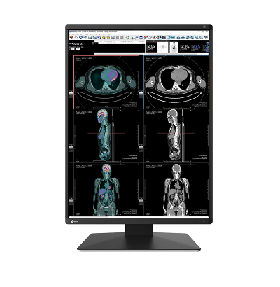 Monitor medyczny EIZO RadiForce RX370