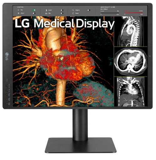 Monitor medyczny LG 21HQ513D-B