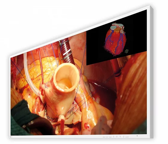 Monitor medyczny EIZO CuratOR EX4342