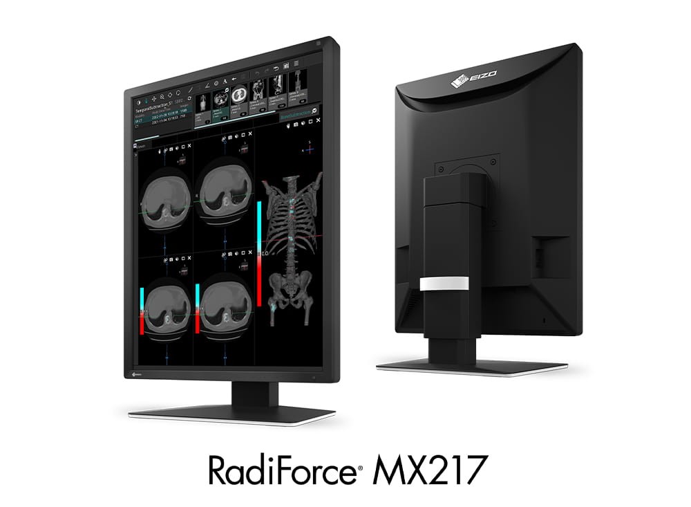 Monitor medyczny RadiForce EIZO MX217