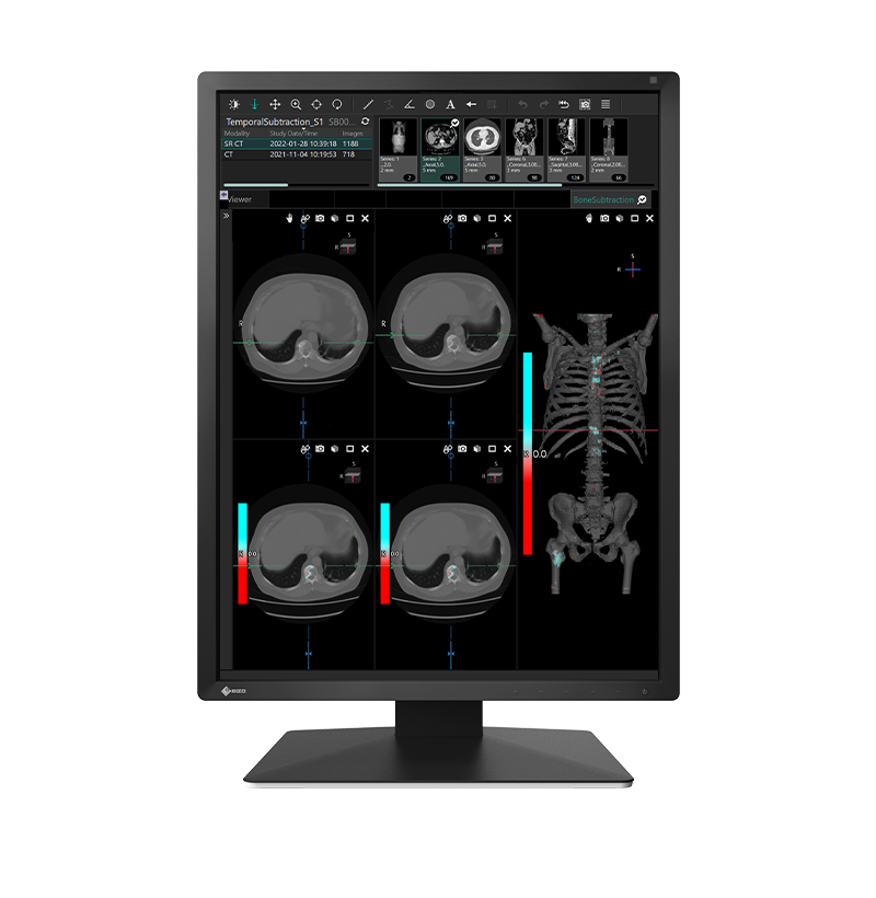 Monitor medyczny RadiForce EIZO MX217