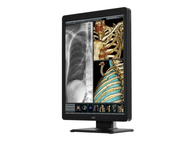 Monitor medyczny JVC CL-S200