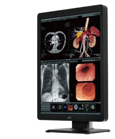 Monitor medyczny JVC CL-R211