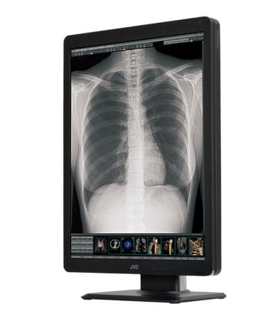 Monitor medyczny JVC CL-S300