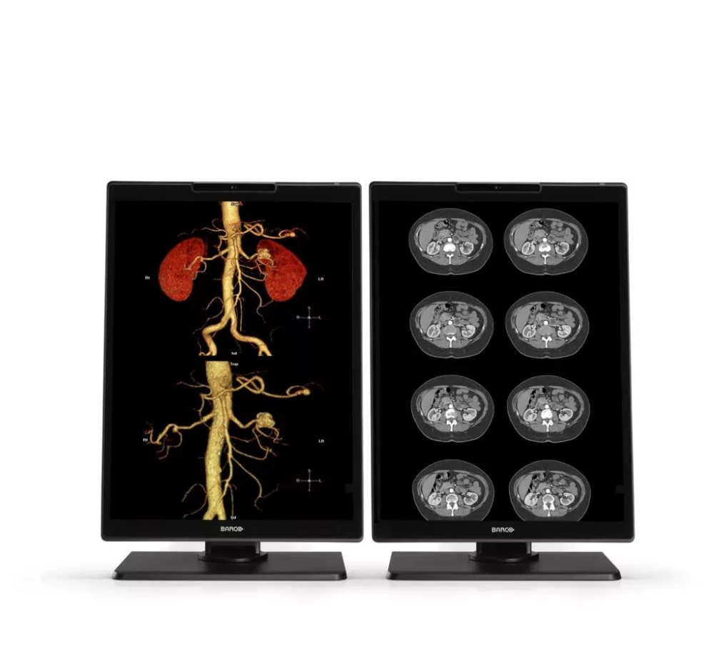 Monitor medyczny Barco Nio Color 3MP MDNC-3521 SPEC