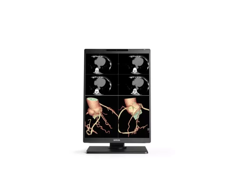 Monitor medyczny Barco Nio Color 3MP MDNC-3521 SPEC