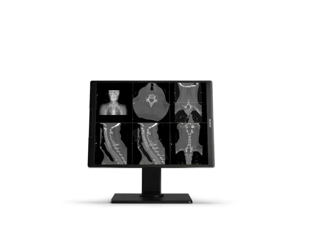 Monitor medyczny Barco Nio Color 3MP MDNC-3521 SPEC