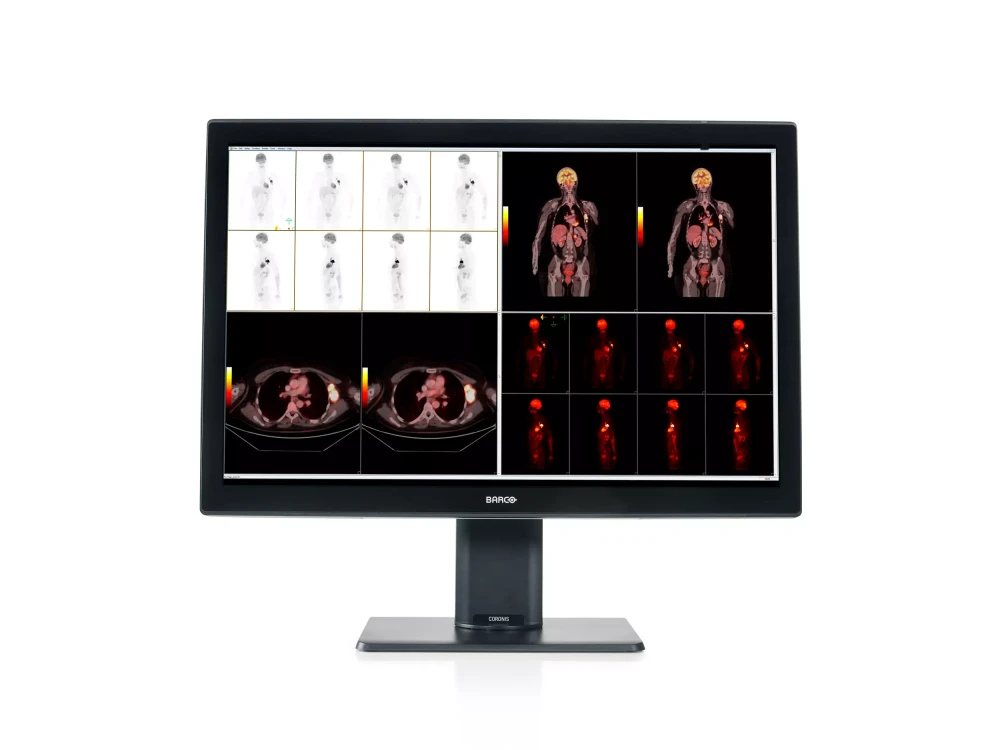 Monitor medyczny Barco Coronis Fusion 6MP (MDCC-6530)