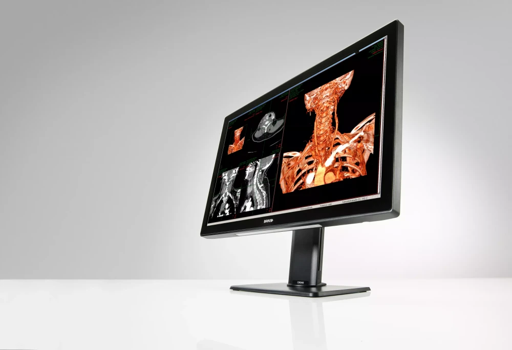 Monitor medyczny Barco Coronis Fusion 6MP (MDCC-6530)