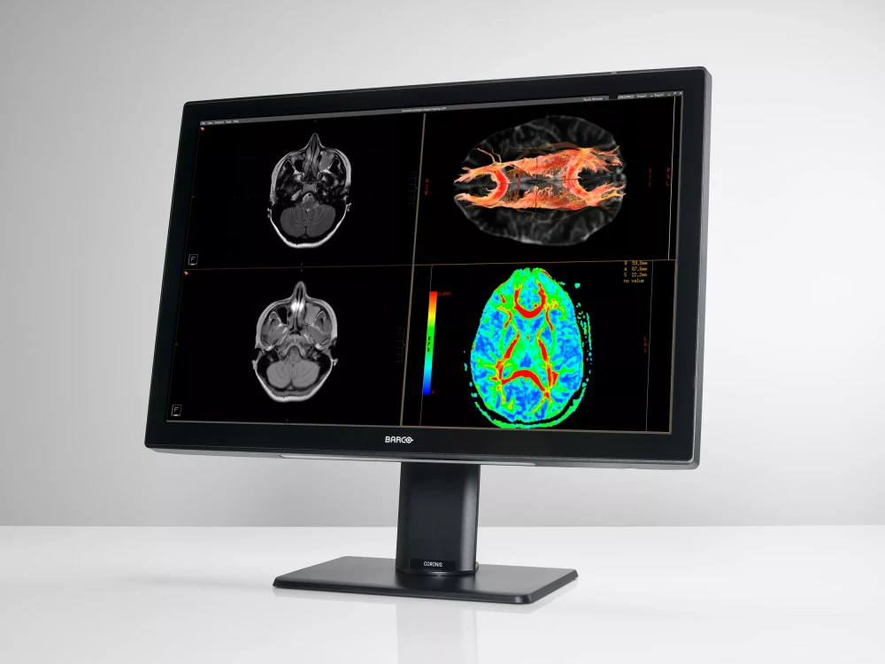 Monitor medyczny Barco Coronis Fusion 6MP (MDCC-6530)