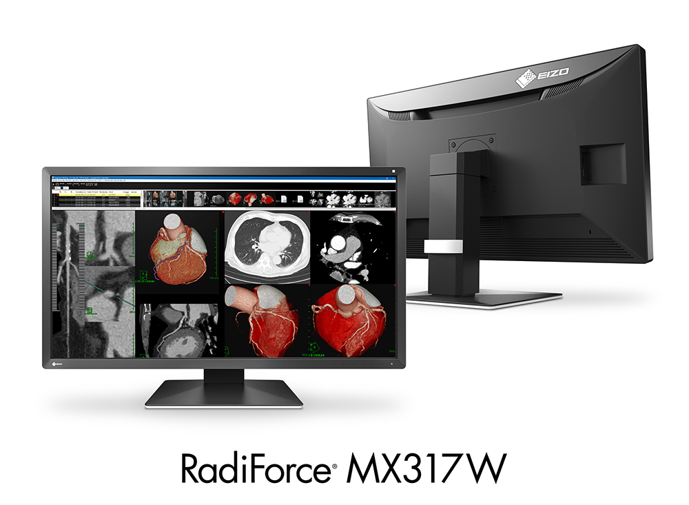Monitor medyczny EIZO RadiForce MX317W