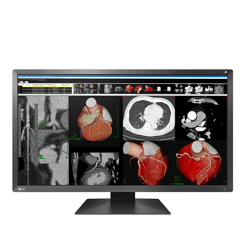 Monitor medyczny EIZO RadiForce MX317W