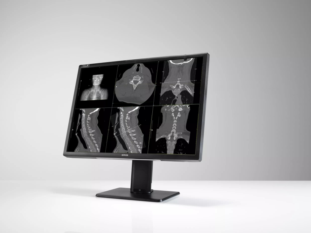 Monitor medyczny Barco Nio Fusion 12MP MDNC-12130