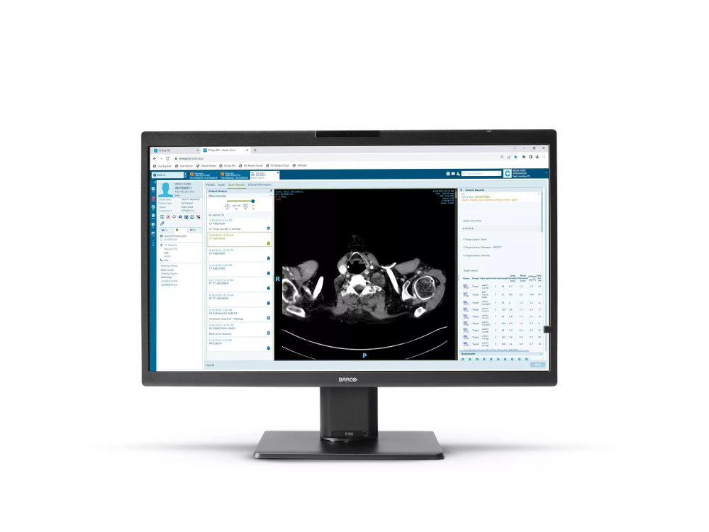 Monitor medyczny Barco Eonis Color 8MP MDRC 8132