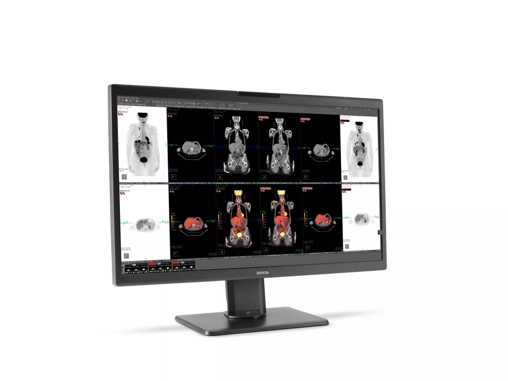 Monitor medyczny Barco Nio Color 8MP MDNC‑8132