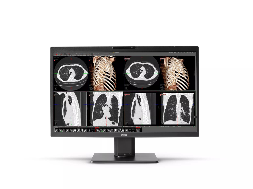 Monitor medyczny Barco Nio Color 8MP MDNC‑8132