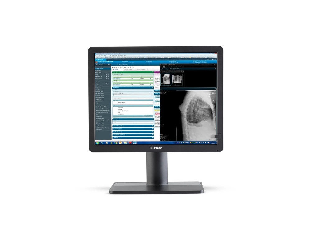 Monitor medyczny Barco Eonis 22" MDRC-2421 SNIB