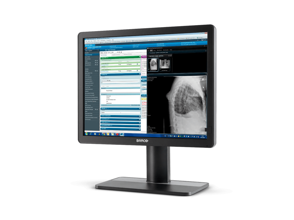 Monitor medyczny Barco Eonis 22" MDRC-2421 SNIB
