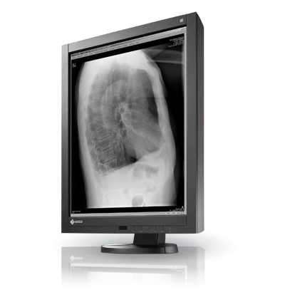 Monitor medyczny EIZO RadiForce GX240