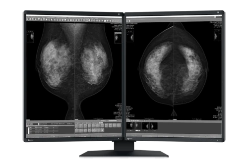 Para monitorów medycznych EIZO RadiForce GX570-MD (2 monitory)