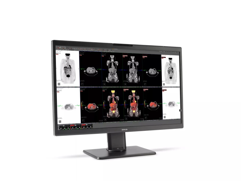 Monitor medyczny Barco Nio Color 8MP MDNC-8132 SNES MKII