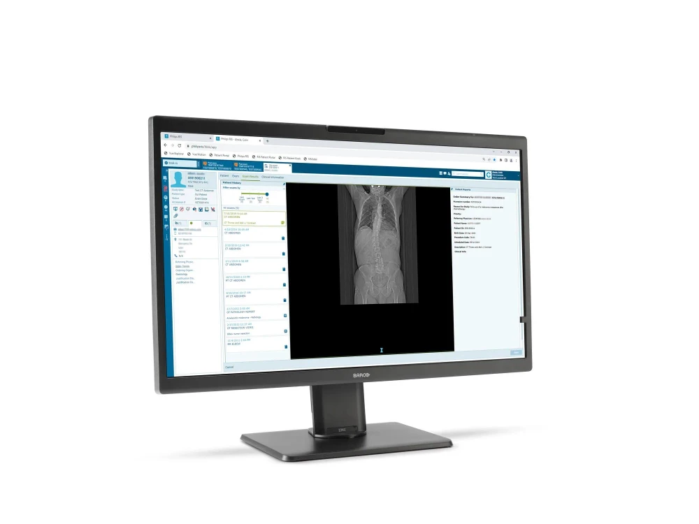 Monitor medyczny Barco Eonis Color 8MP MDRC-8132 MKII