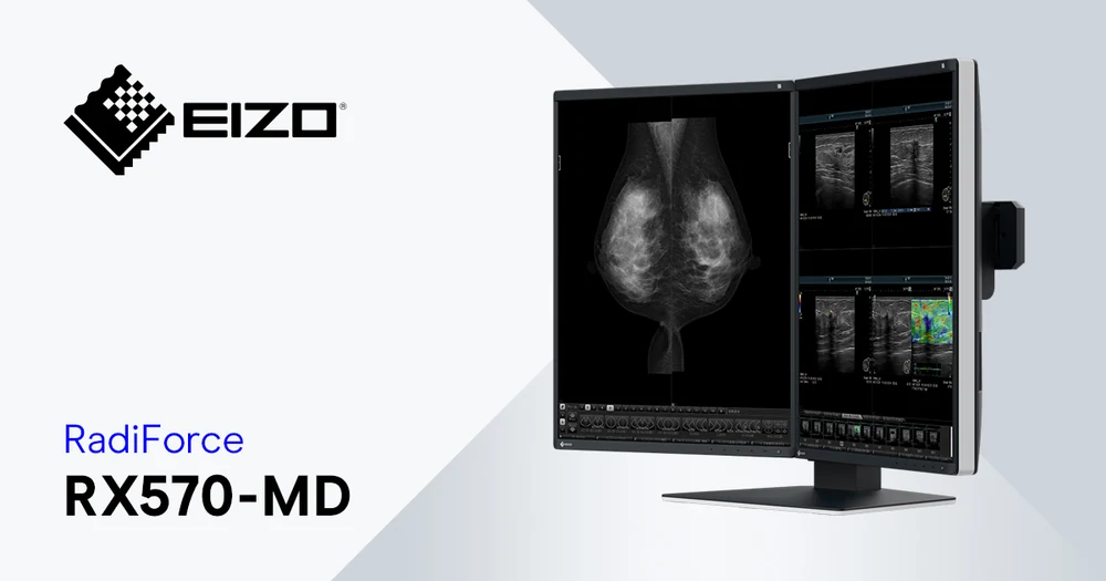 Zestaw monitorów diagnostycznych EIZO RadiForce RX570-MD MammoDuo – ujęcie ukośne dwóch ekranów — wyswietlanie.com.pl