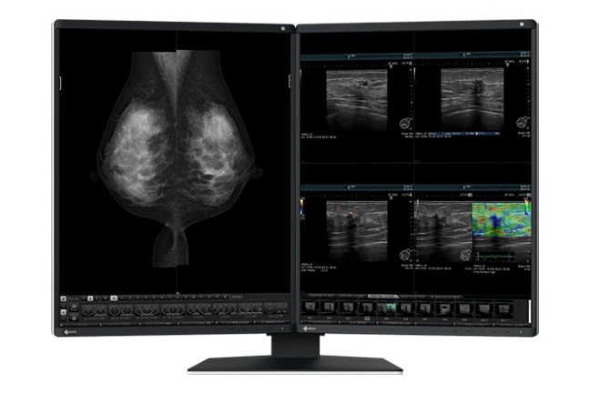 Zestaw monitorów diagnostycznych EIZO RadiForce RX570-MD MammoDuo – dwa pionowe ekrany od przodu — wyswietlanie.com.pl