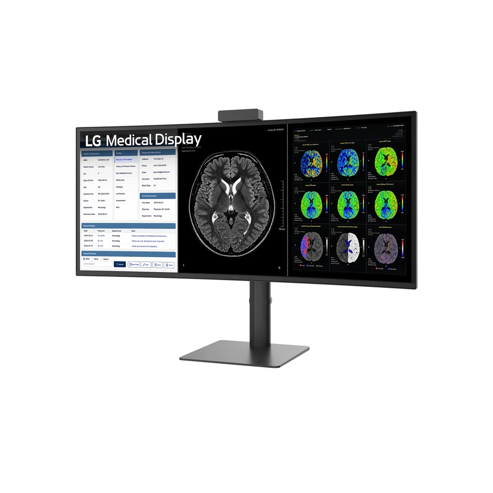 Monitor diagnostyczny LG UltraWide 40″ 40HT513D-B – ujęcie z przodu pod kątem, na podstawie, z obrazami mózgu na ekranie — wyswietlanie.com.pl