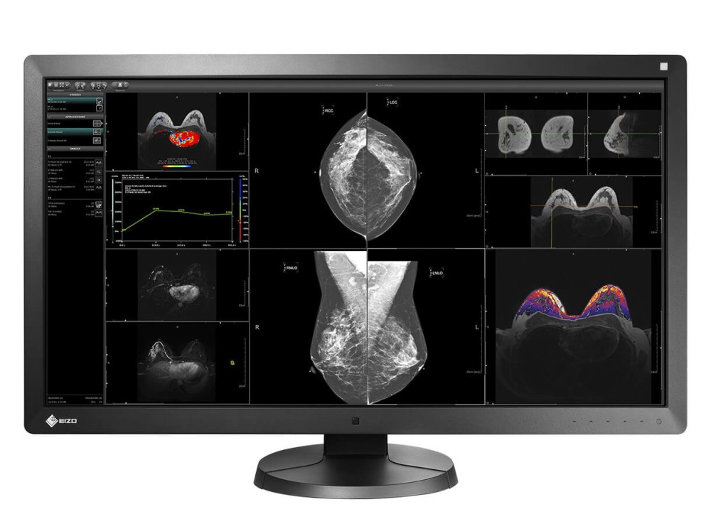 Monitor medyczny EZIO RadiForce RX850