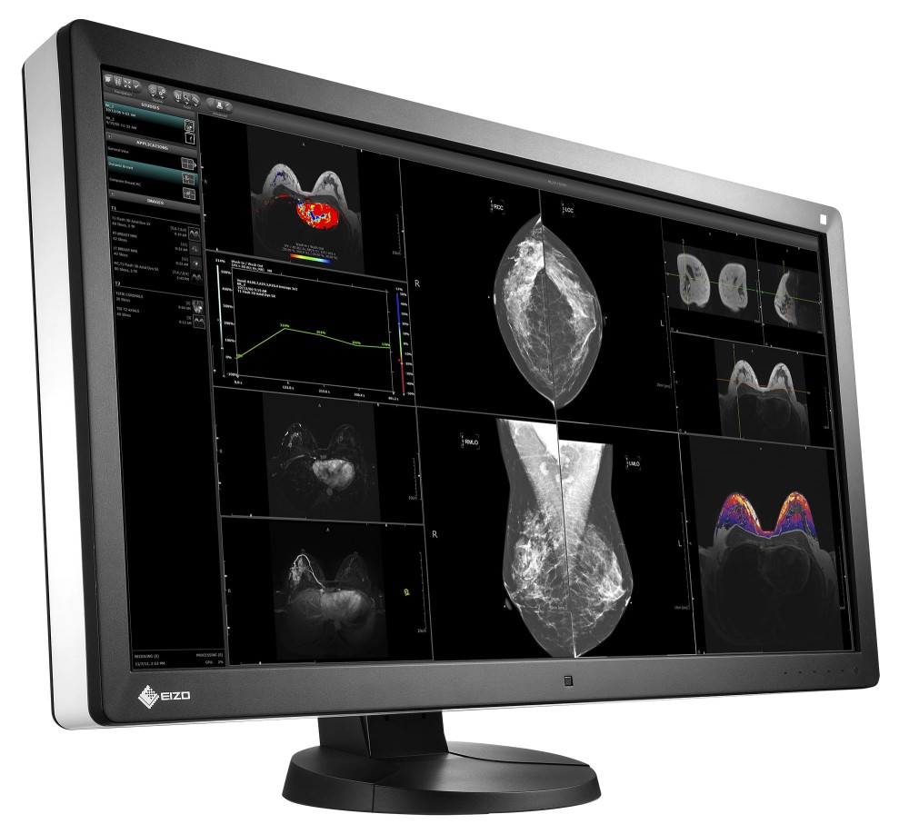 Monitor medyczny EZIO RadiForce RX850