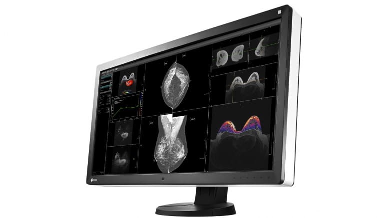 Monitor medyczny EZIO RadiForce RX850