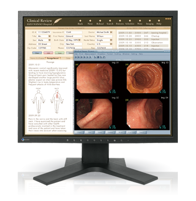 EIZO RadiForce MX191