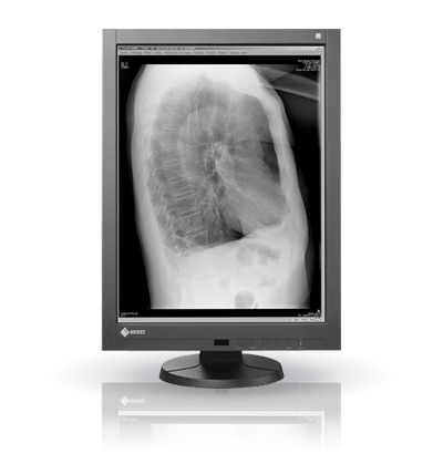 Monitor medyczny EIZO RadiForce GX240