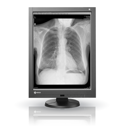 Monitor medyczny EIZO RadiForce GX340
