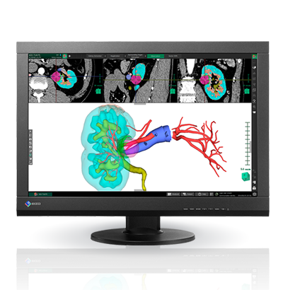 Monitor medyczny EIZO RadiForce MX242W