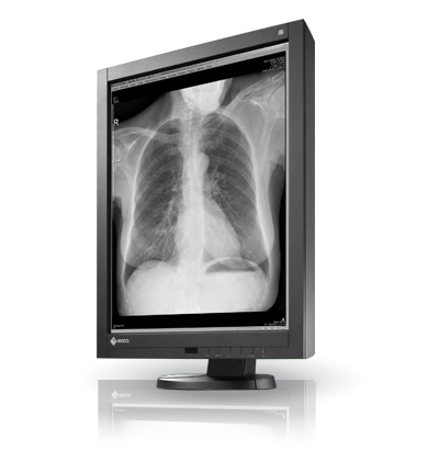 Monitor medyczny EIZO RadiForce GX340