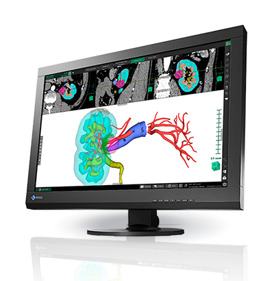 Monitor medyczny EIZO RadiForce MX242W