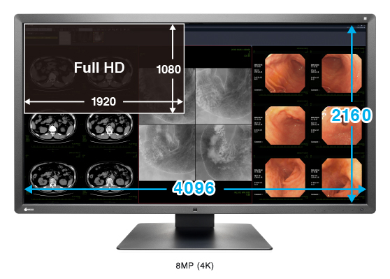 EIZO RadiForce MX315W