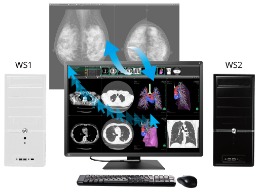 EIZO RadiForce RX1270