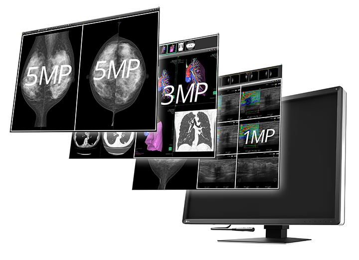 EIZO RadiForce RX1270