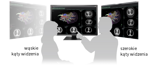 EIZO RadiForce RX660