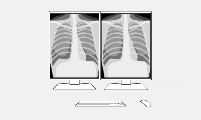 Para monitorów medycznych EIZO RadiForce GX570-MD (2 monitory)